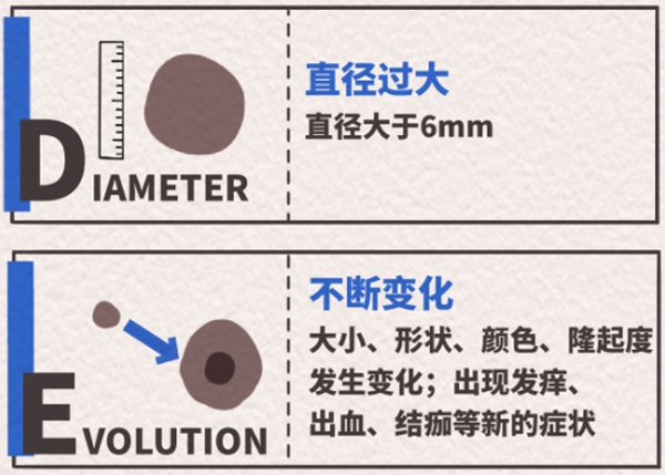 五步法（二）。重慶松山醫(yī)院供圖